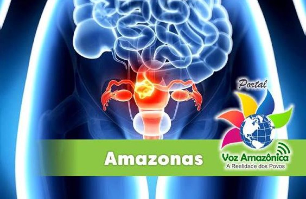 Amazonas tem como um dos grandes desafios na saúde pública, e também na privada, conscientizar sobre a importância da prevenção à doença - Imagem: Divulgação/PVA.